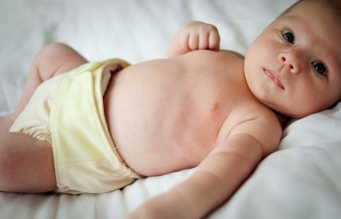 Kenali Penyebab Ruam Popok Pada Bayi dan Cara Mengatasinya