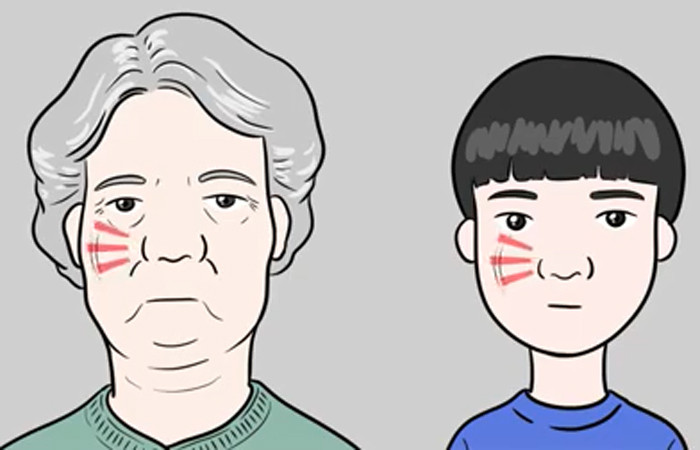 Derita Hidung Gendut Dan Larangan Operasi Plastik Hidung Terbaik Di Korea