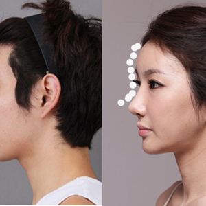 Dahi S Line Berpengaruh Pada Operasi Plastik Hidung Terbaik Di Korea
