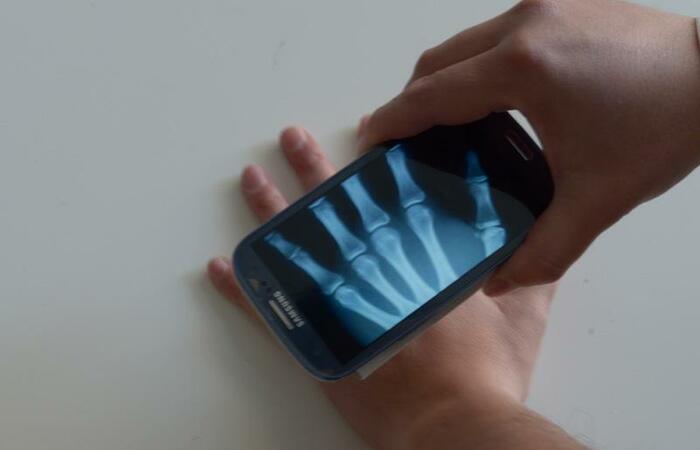 Aplikasi X-Ray Android Untuk Melihat Organ Tubuh dan Tulang